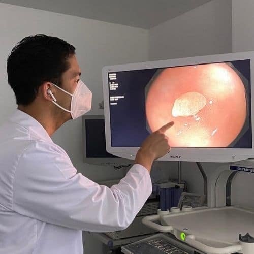 Pólipos colon - Dr Nicolás Betancur - Coloproctólogo